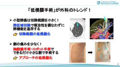 スライド