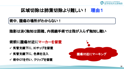 スライド