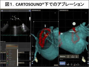 }1.CARTOSOUNDł̃Au[V