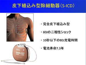 牺A݌^דiS-ICDj