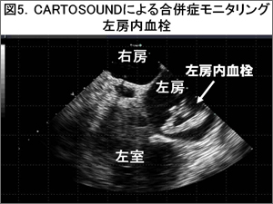 }5.CARTOSOUNDɂ鍇ǃj^O@[